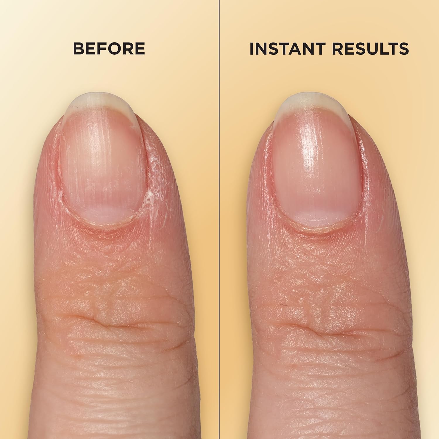 Sally Hansen Nail Treatment Vitamin E Nail & Cuticle Oil™ | Enriched with Natural Essential Oils & Vitamin E | Deeply Nourishes & Conditions Dry Nails & Cuticles